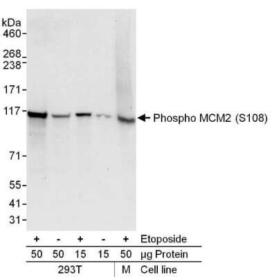 <b>Biological Strategies Validation. </b>Western Blot: MCM2 [p Ser108] Antibody [NB100-639] - Whole cell lysate (15 or 50 ug) from 293T cells or mouse NIH3T3 (M) cells. Cells were either mock treated (-) or treated (+) with EPE (100 uM, 2h). Antibody used at 0.1 mcg/ml.